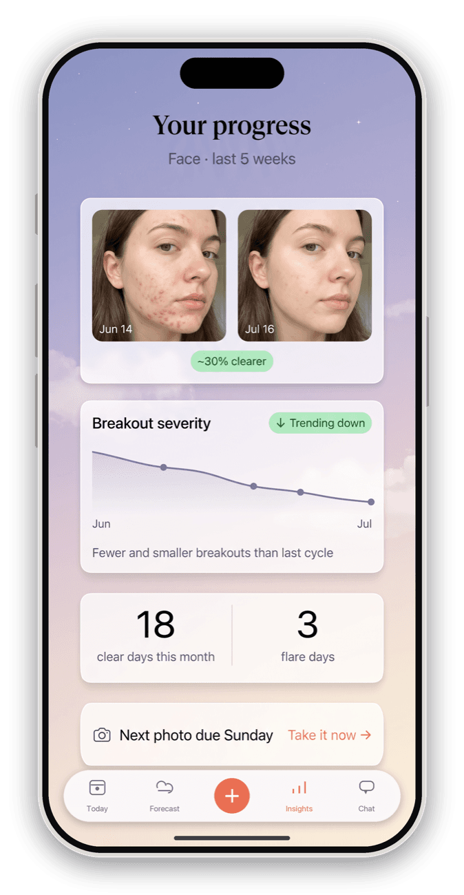 Progress screen comparing skin across two months with a severity trend.