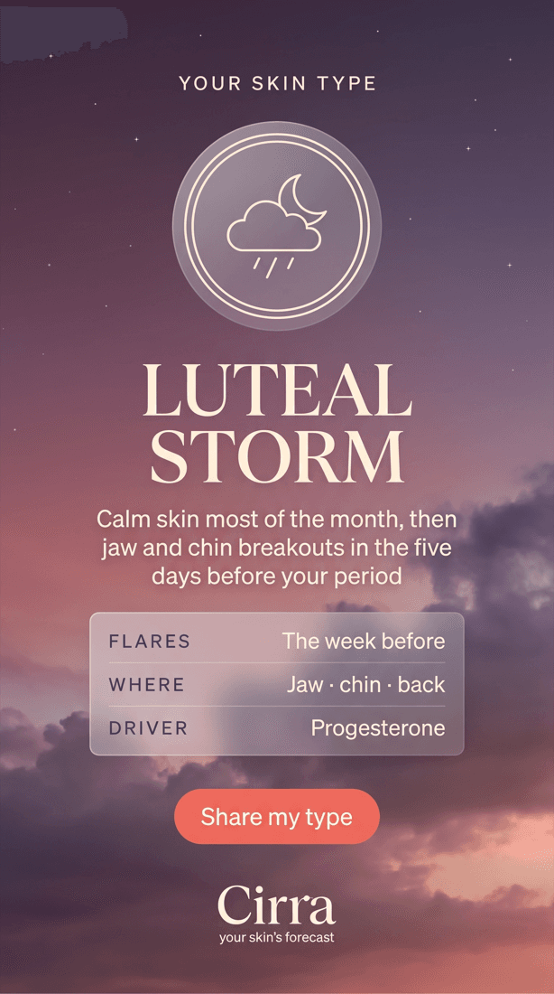 A skin-cycle type reveal card for The Luteal Storm, listing when flares happen, where, and the driver.